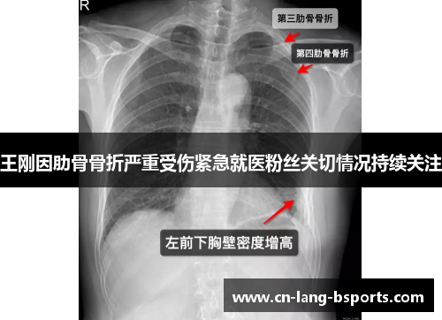 王刚因肋骨骨折严重受伤紧急就医粉丝关切情况持续关注